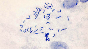 An image of another chromosome from the same northern gelada individual