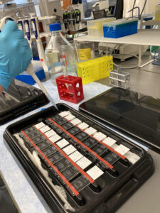 Adding primary antibody to tissue samples!